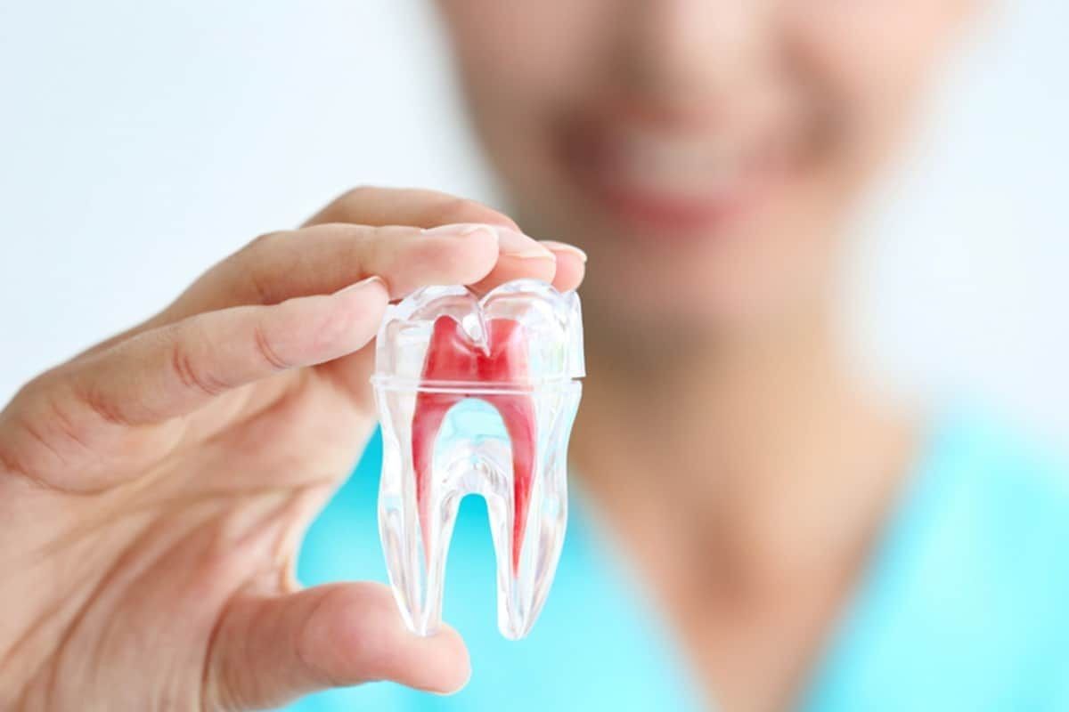 Blanquear un diente amarillo por endodoncia