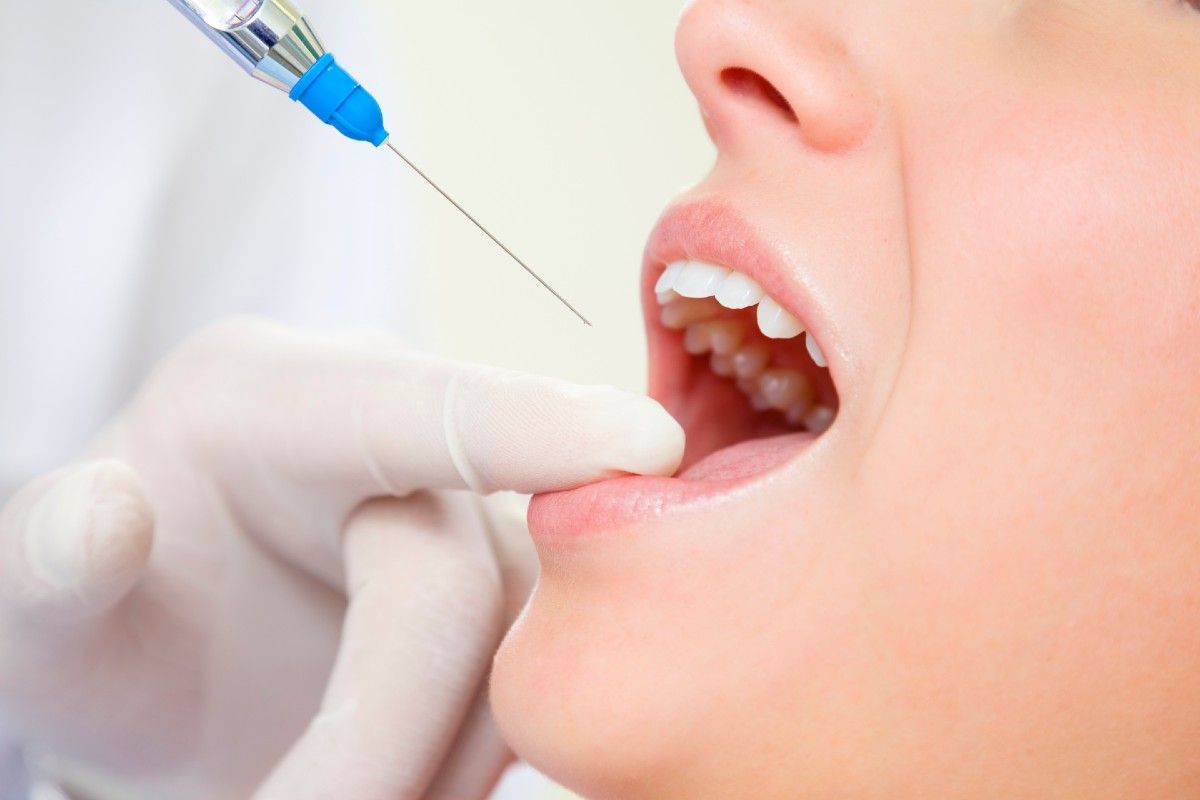 Tipos de anestesia dental