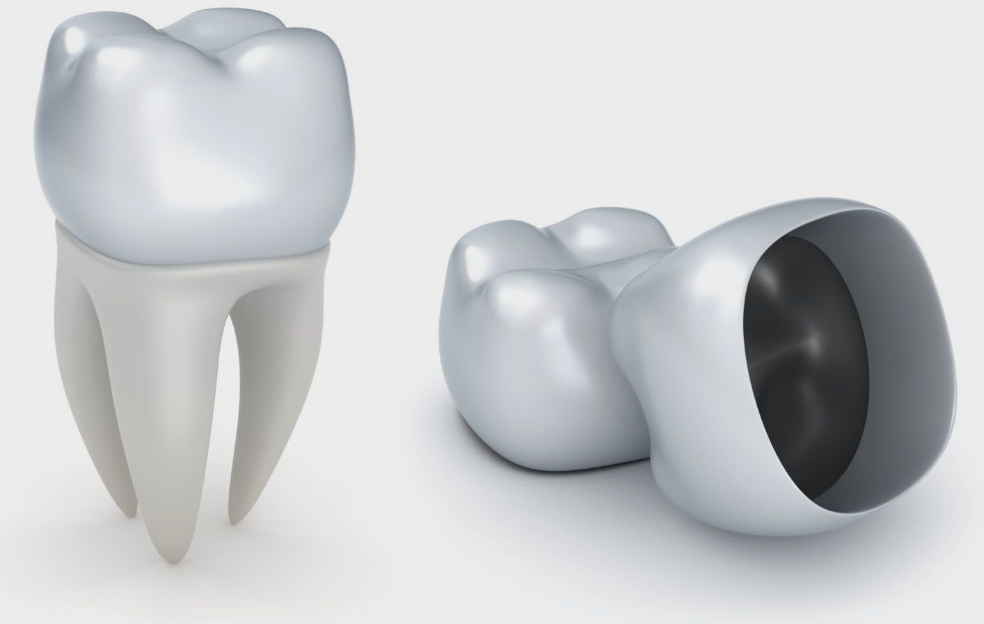 coronas dentales, fundas dentales, clínica dental Madrid,