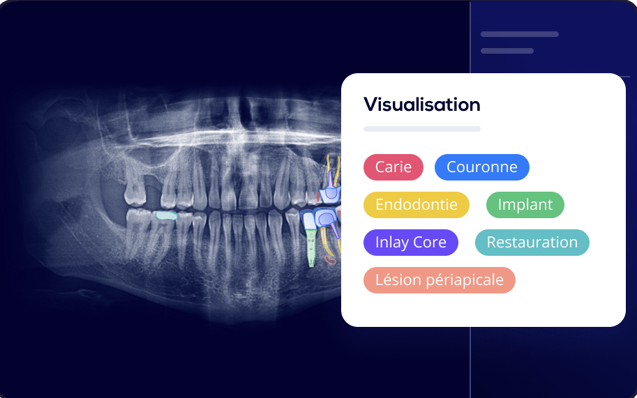 inteligencia artificial en odontología con herramienta software allisone, planificación digital