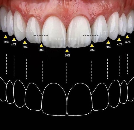 Diseño de sonrisa en Madrid, el diseño de sonrisa más avanzado y digital. Diseño de sonrisa integral para tratamientos dentales en clínica maxilofacial calvo de mora