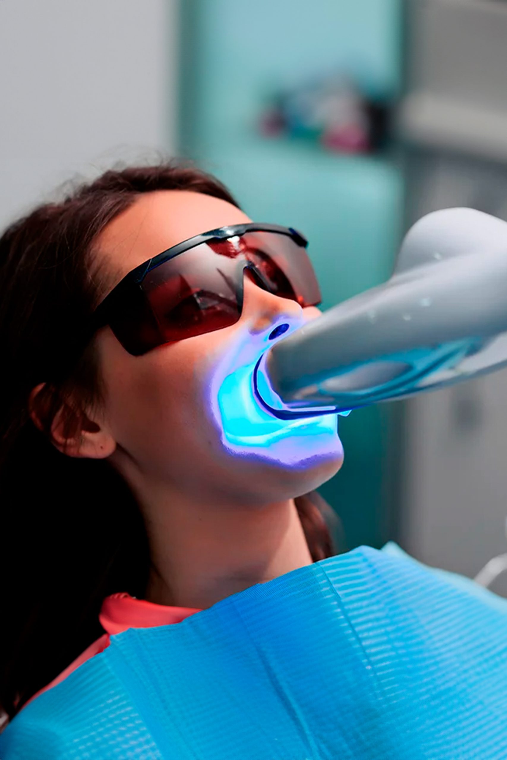 tratamiento blanqueamiento dental mejor clínica estética dental, blanqueamiento luz led dientes más blancos, blanquear sonrisa calvo de mora