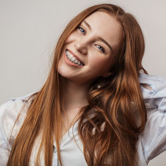 tratamiento para alinear los dientes en madrid. Ortodoncia estética, brackets transparentes, invisalign. Mejores ortodoncistas de madrid