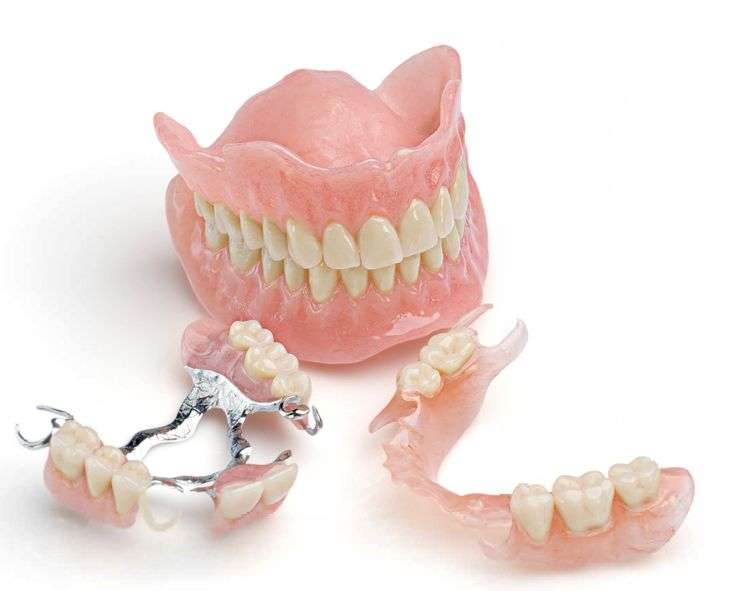 clínica maxilofacial Calvo de Mora Madrid dentista, rehabilitación oral, arreglar boca, prótesis dentales removibles, centro dental Madrid