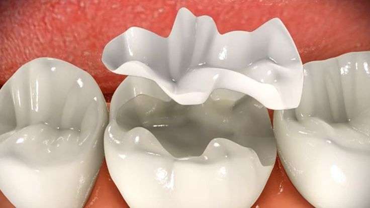 clínica maxilofacial Calvo de Mora Madrid dentista, rehabilitación oral, arreglar boca, incrustaciones dentales, precio centro bucodental