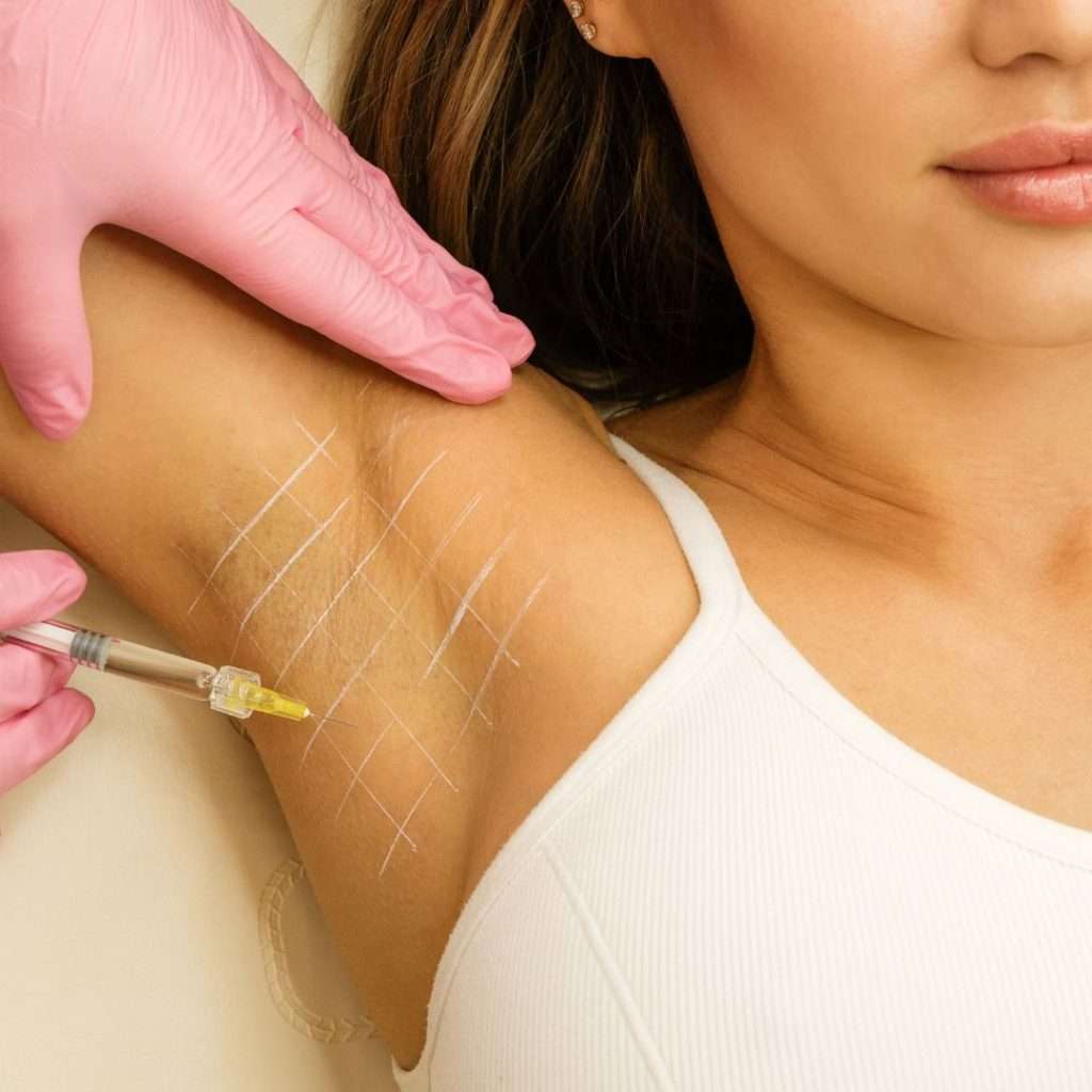 tratamiento para la hiperhidrosis con toxina botulínica, sudor excesivo, clinica estética