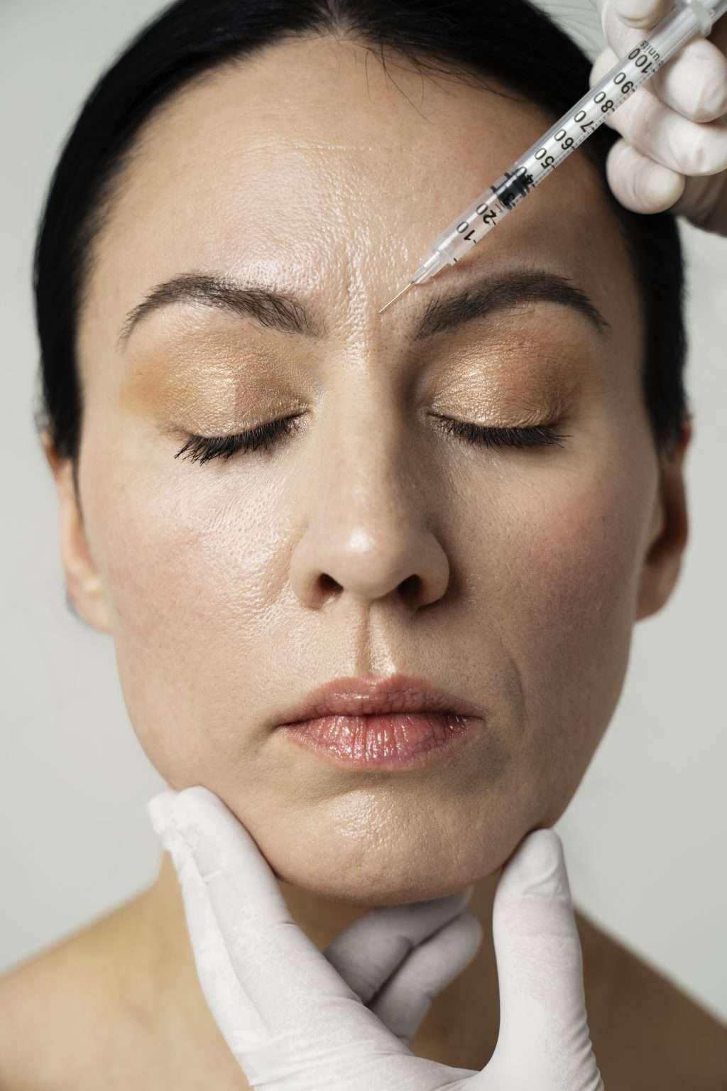 Toxina botulínica, botox para el bruxismo, eliminar patas de gallo, tratamiento botox, clínica maxilofacial Calvo de Mora, estética facial.