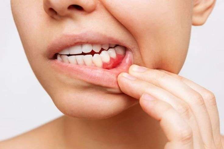 clínica maxilofacial calvo de Mora Madrid, enfermedades bucodentales, enfermedades dentales más frecuentes, dentista Madrid, especialista maxilofacial