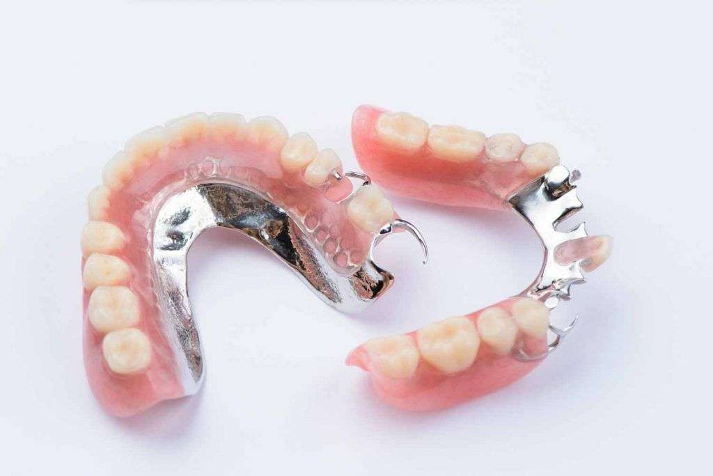 clínica dental maxilofacial Madrid, dentadura postiza, prótesis removibles metálicas en Madrid