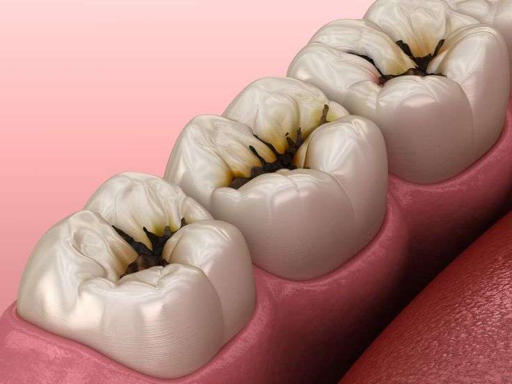 clínica maxilofacial calvo de Mora Madrid, enfermedades bucodentales, enfermedades dentales más frecuentes, dentista Madrid, especialista maxilofacial