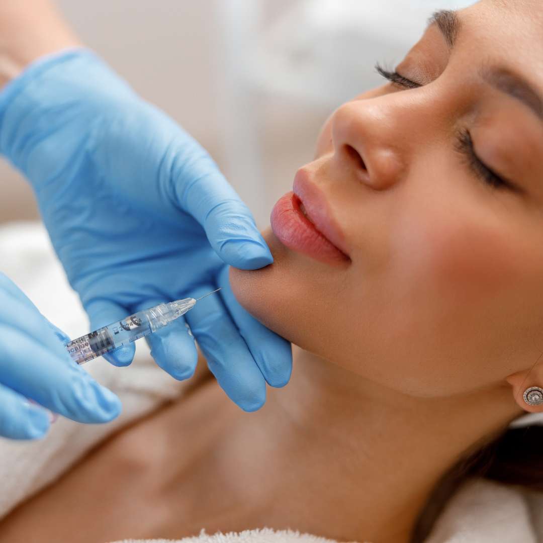 aumento mentón ácido hialurónico, clínica estética facial Madrid, Maxilofacial tratamientos ácido hialurónico precios Madrid. elevación menton