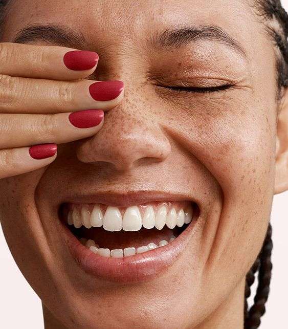 tratamiento blanqueamiento dental led profesional en clínica dental Madrid, dientes blancos, diseño de sonrisa, carillas dentales