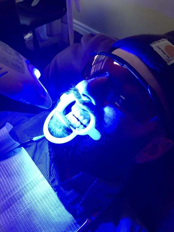 estética dental, blanqueamiento led profesional, clínica dental Madrid, dientes blancos, diseño de sonrisa, carillas dentales, manchas en los dientes