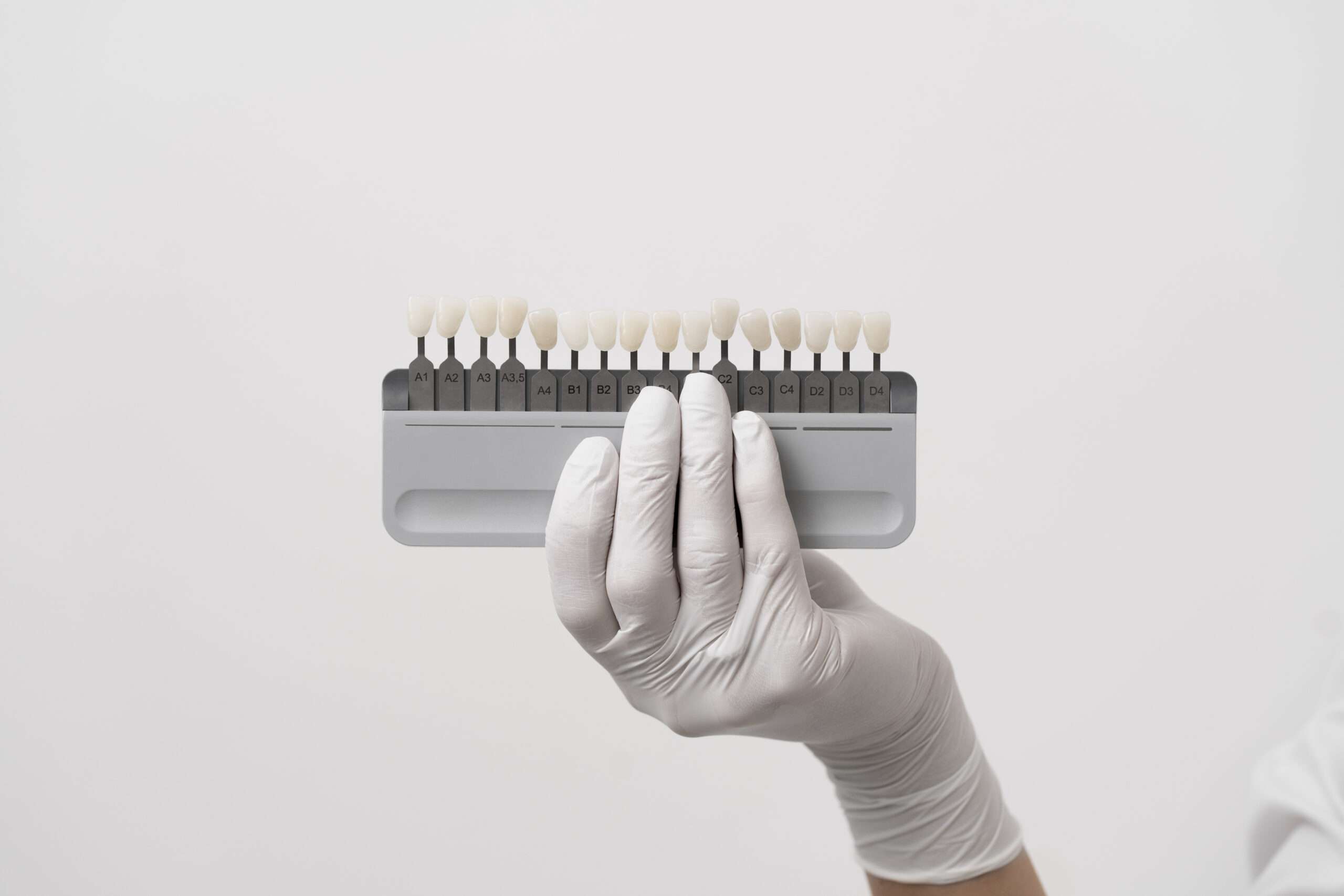 operación con carillas, carillas dentales porcelana, procedimiento quirúrgico, clínica maxilofacial Madrid, cirugía ortognática cuidados