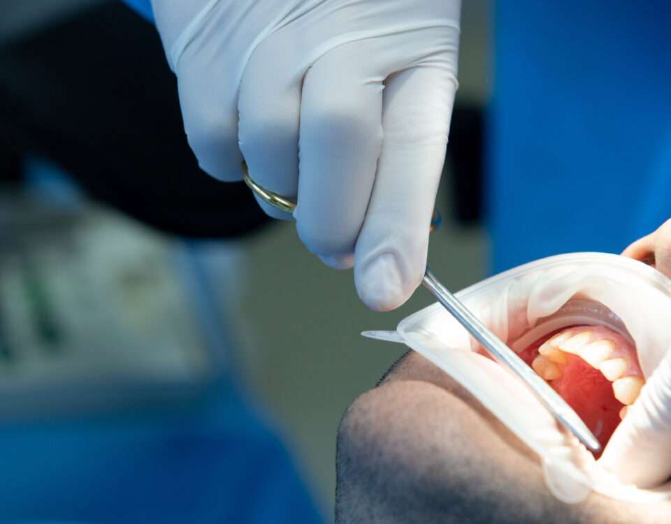 operación con carillas, pacientes, carillas dentales, después procedimiento quirúrgico, clínica maxilofacial Madrid, cirugía ortognática