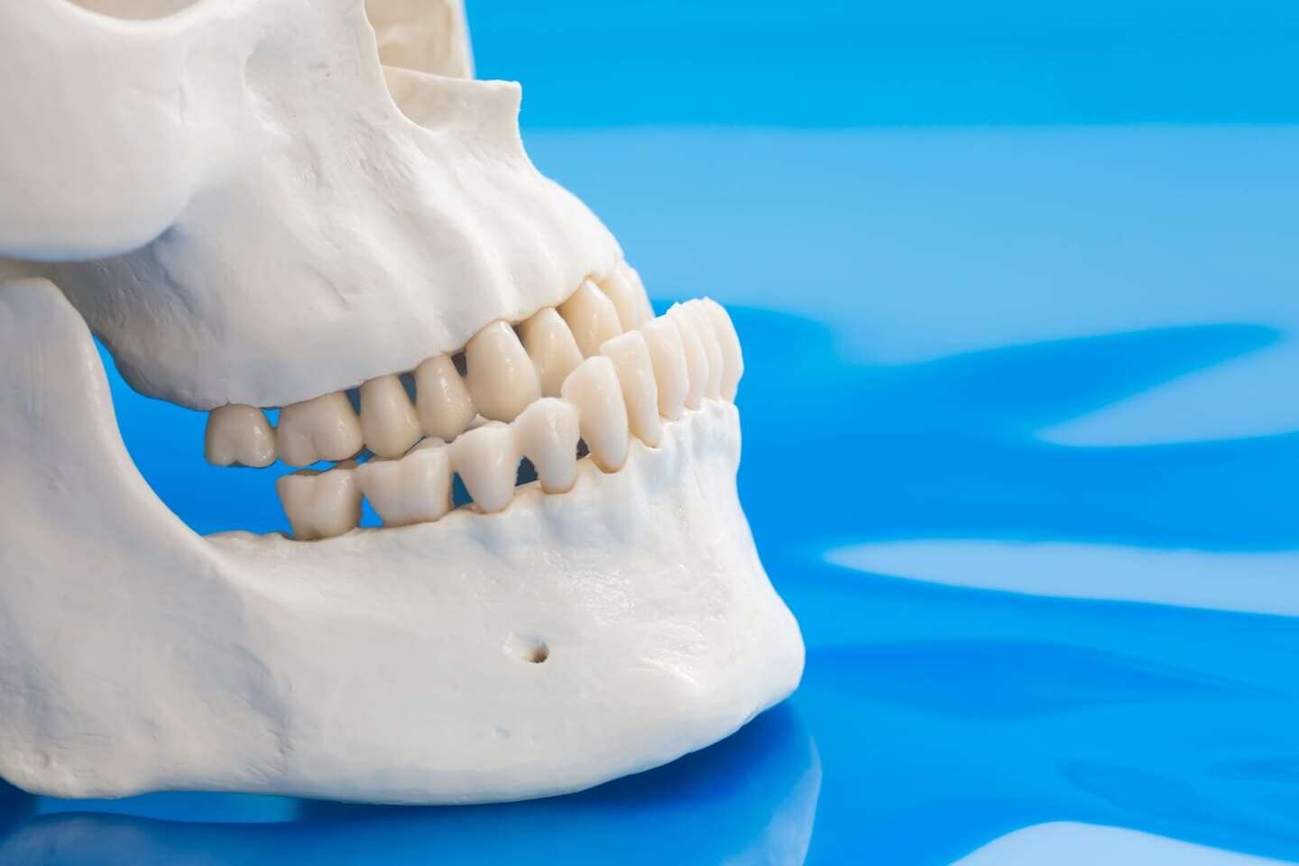 Prognatismo mandibular, clase 3 ortognática, clínica maxilofacial Madrid, Dr calvo de mora, cirujano maxilo, corregir mandíbula, cirugía ortognática