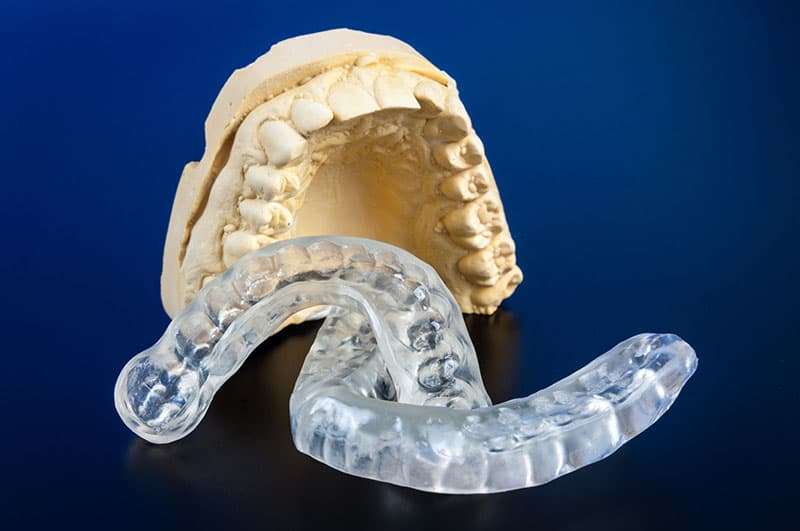 Para qué sirve la férula de descarga, cómo se limpia la ferula de descarga, ferula de descarga precios, tipos de férulas, dentista madrid