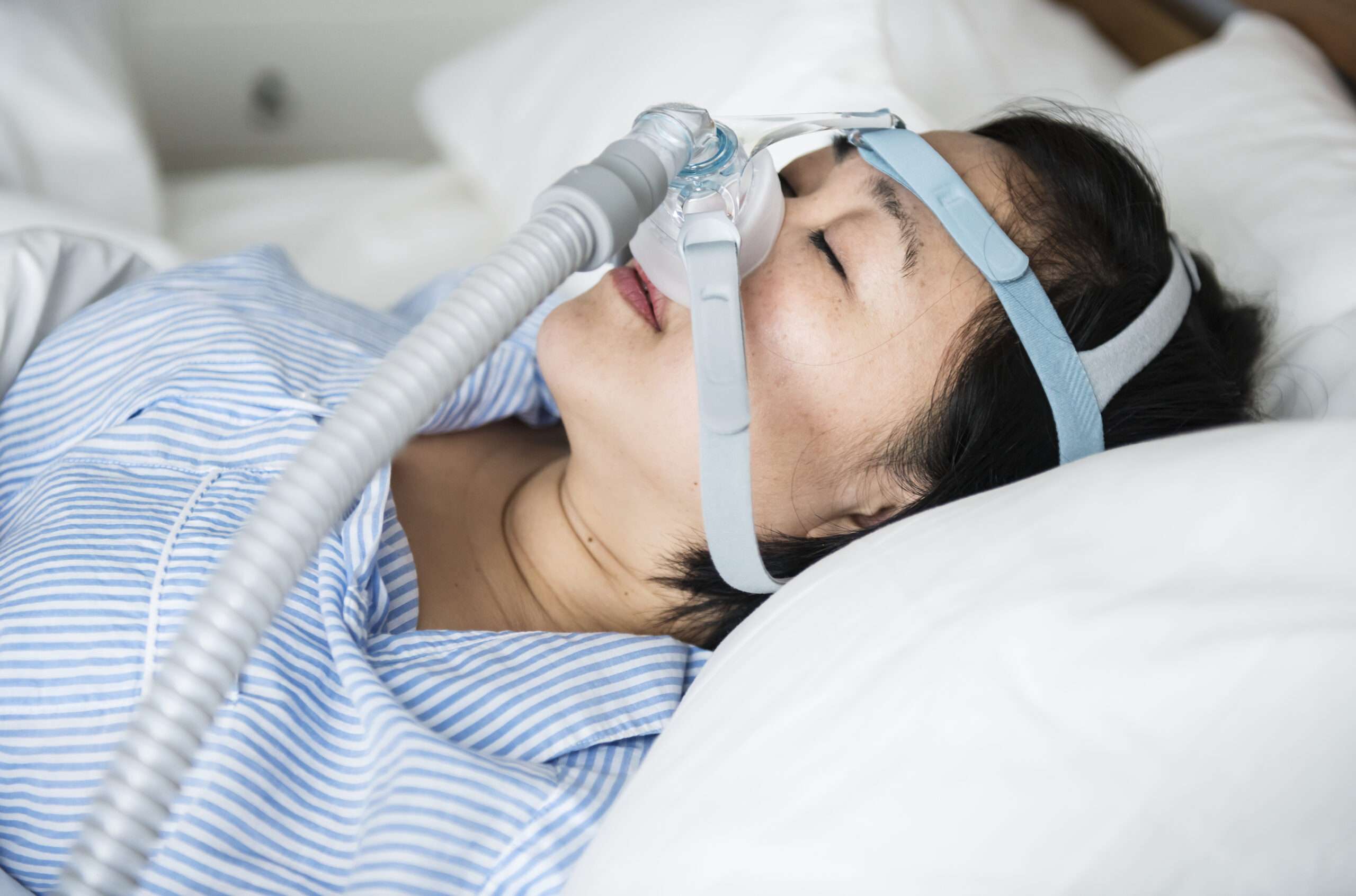 Apnea del sueño SAOS, dispositivo de respiración para evitar ronquidos, no tratar la apnea obstructiva del sueño