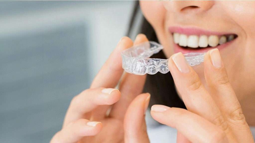 Clínica Dental para tratamiento de ortodoncia invisible en Madrid. Especialistas corregir los diente con alineadores invisibles de la marca invisalign o spark