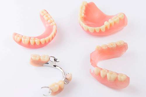 Tipos de prótesis dentales que existen, características de las prótesis removibles y fijas, rehabilitación oral con prótesis o implantes