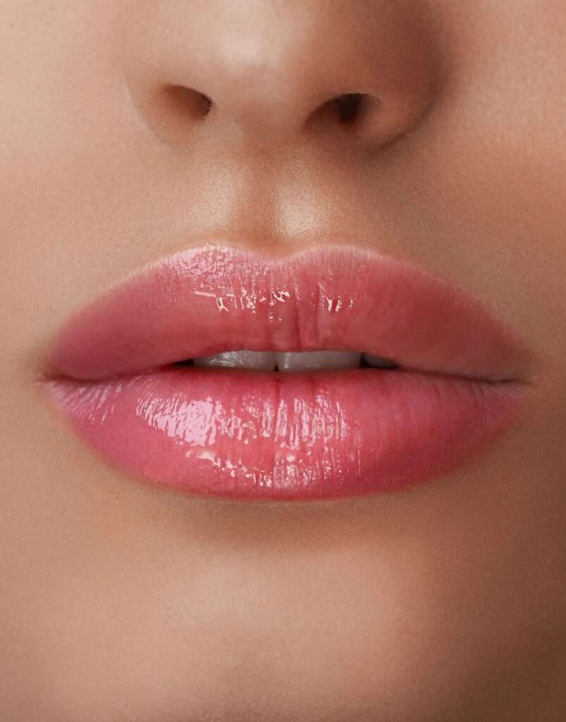 queiloplastia para unos labios estéticos y funcionales, quitar la silicona de los labios para una apariencia natural