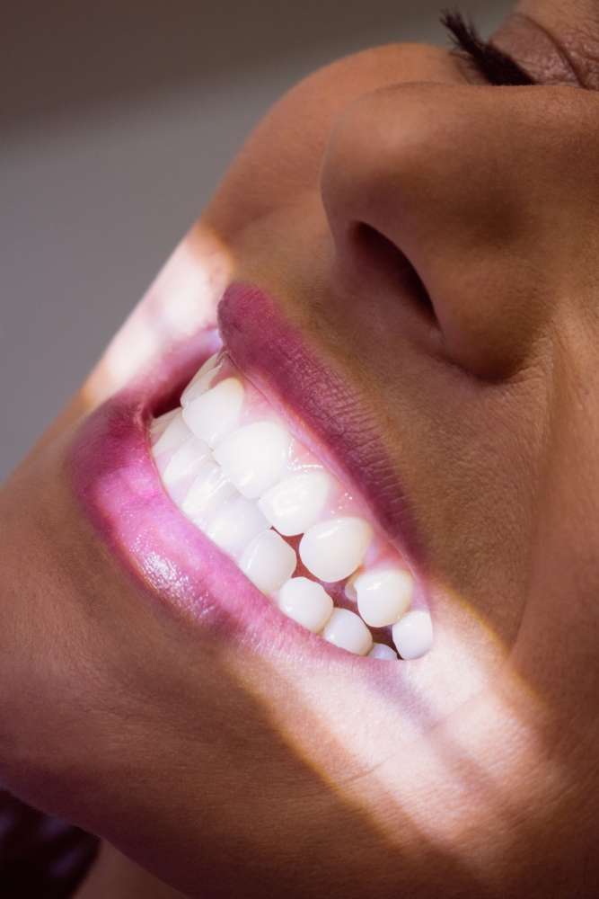 clínica de estética dental en Madrid, blanqueamiento dental LED profesional, tratamiento dental seguro y natural, diseño de sonrisa digital