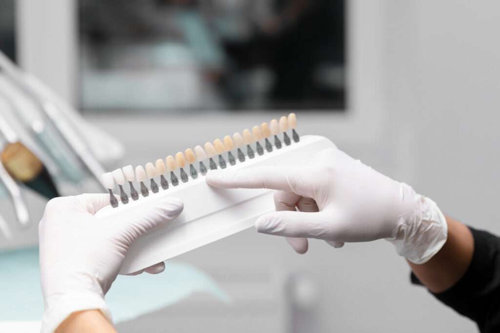 Estética Dental de calidad en Madrid con el tratamiento de carillas guiadas en mejor clínica maxilofacial en Madrid, carillas porcelana