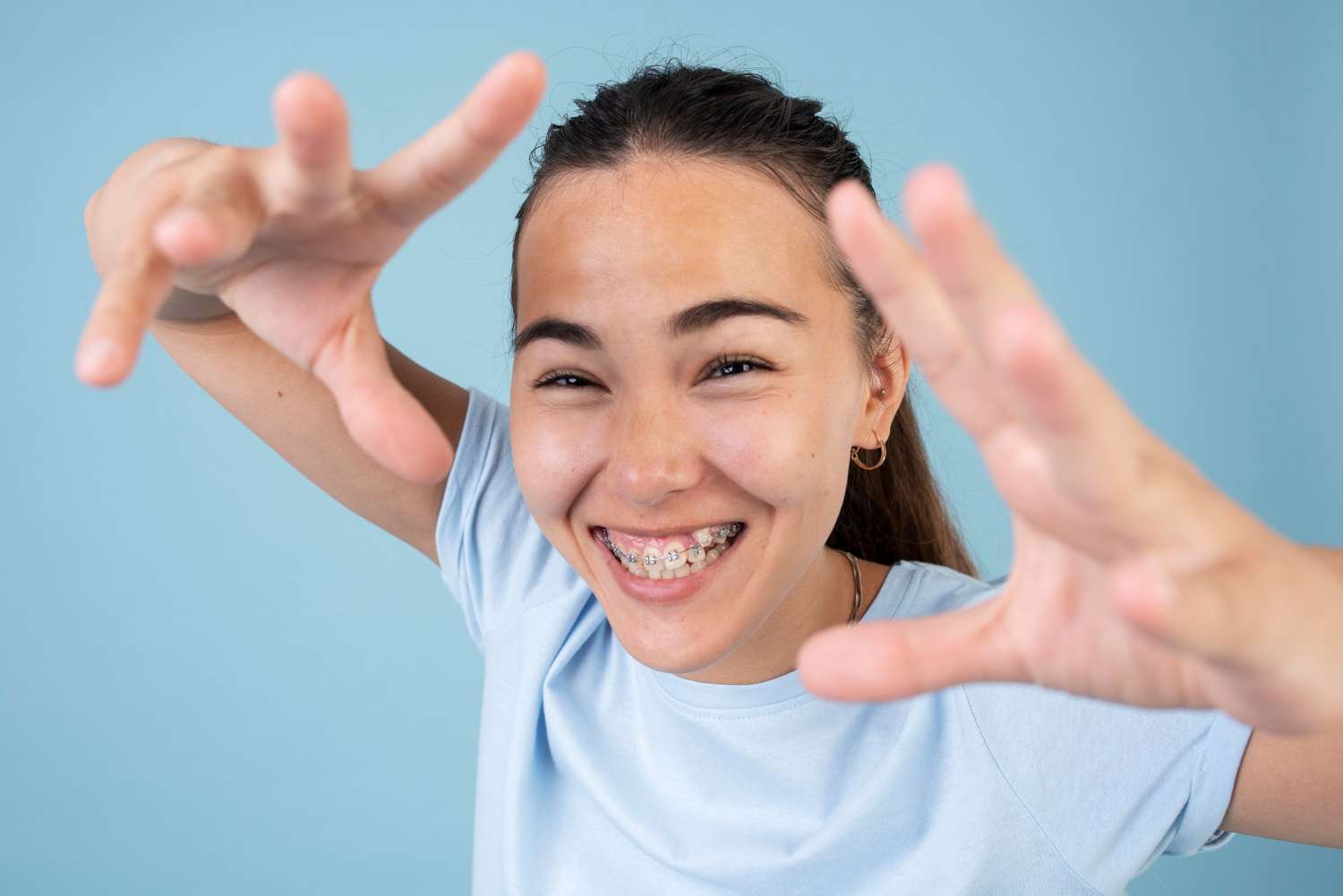 para un tratamiento de ortodoncia rápido y eficaz acude a la clínica dental en Madrid Calvo de Mora, especialistas en brackets, invisaling, alineamos tu mordida
