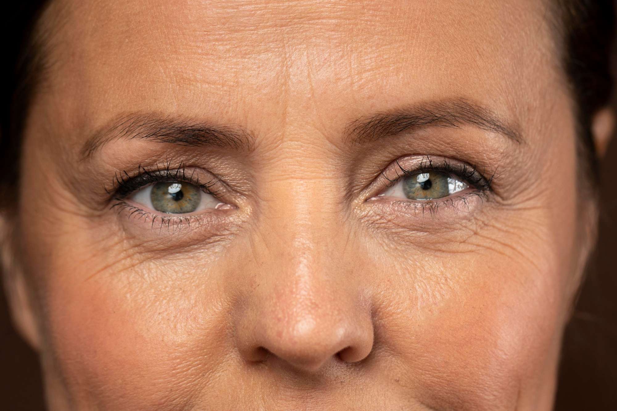 el parpado caído tiene solución, blefaroplastia en madrid, clínica especializada para eliminar el exceso de piel en el párpado