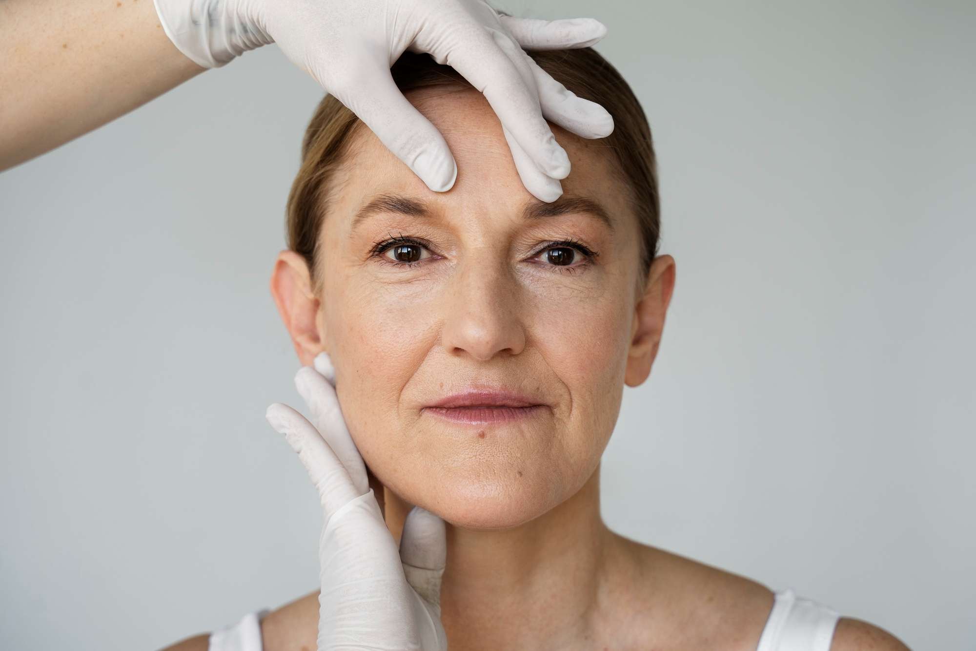 eliminar el exceso de párpado con cirugía blefaroplastia, clínica especializada en Madrid, cirugía de ojos, rejuvenece tu mirada