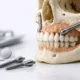Implantes cigomáticos sin hueso: opción real