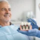 Implantes de carga inmediata: qué esperar