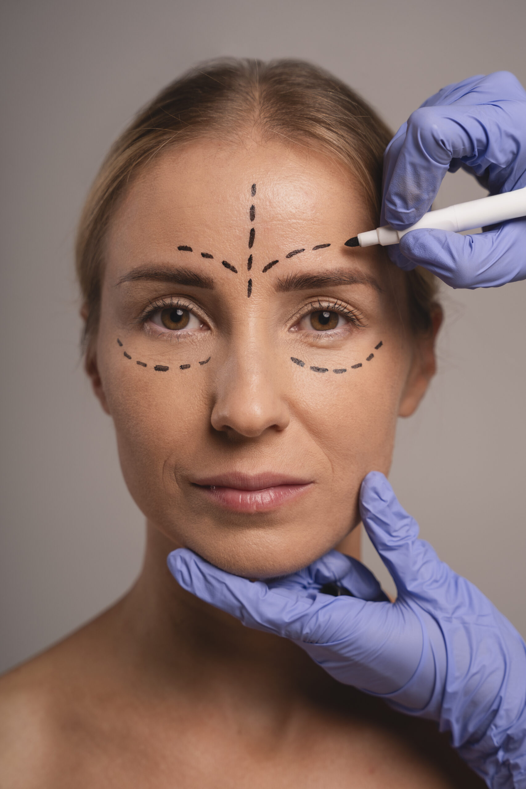 ¿Qué define un perfil facial armónico? en clínica maxilofacial calvo de mora te ayudamos a armonizar tu rosto, cirugías, ácido hialurónico