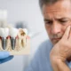 Qué hacer si no tengo hueso para implantes