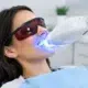 Blanqueamiento dental LED: duración y cuidados