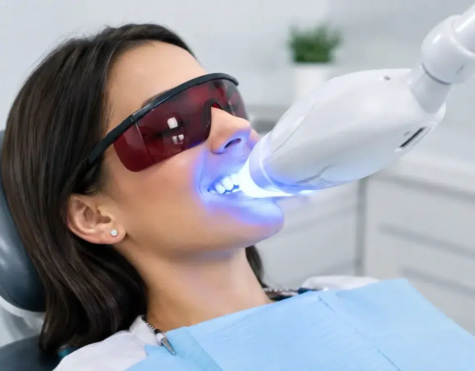 Blanqueamiento dental LED: duración y cuidados