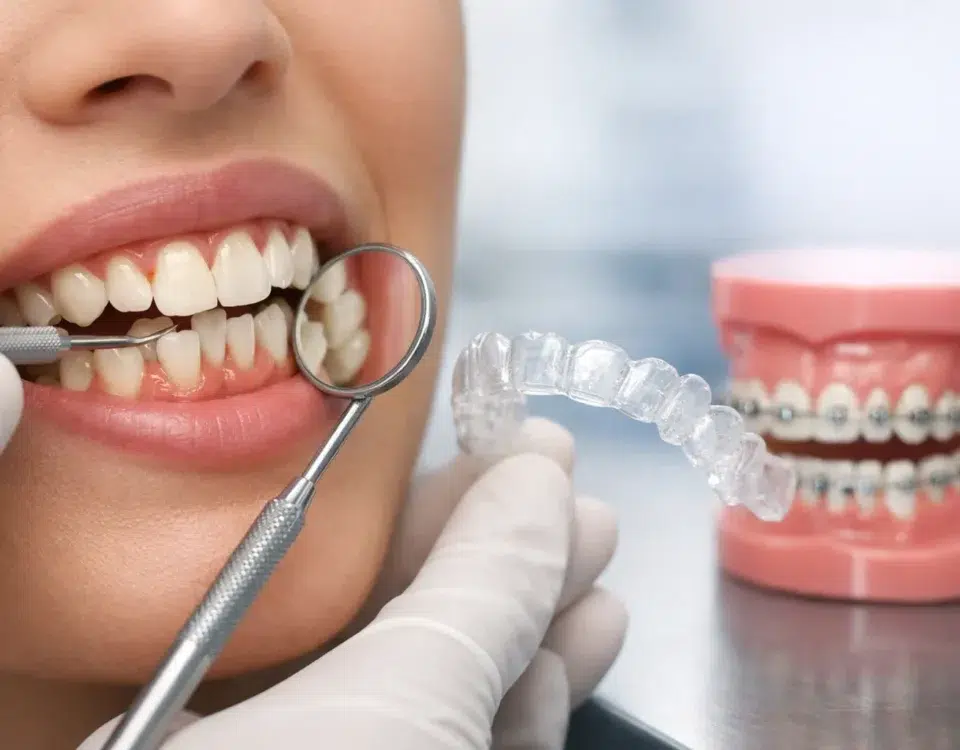 Cómo alinear dientes apiñados con precisión