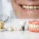 Mejores opciones para dientes desgastados