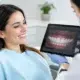 Opiniones sobre diseño de sonrisa digital